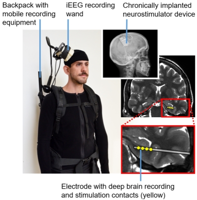 Responsive neurostimulation recording setup